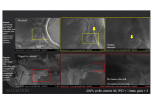 Electron Microscopy validation image for anti-SNAP Tag antibody (ABIN1573927)