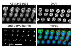 Myosin VIIA antibody