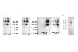 1. Positive control: protein ODF2-His, bacterially expressed, different amounts per lane, detection with anti His-Tag antibody (Novagen, 70796-3, Lot number N37164) (1:1,000). Secondary antibody anti mouse-HRP (Sigma-Aldrich A9044, Batch Number 034M4761) (1:10,000). 2. Test: protein ODF2-His, bacterially expressed, different amounts per lane, detection with anti ODF2 (ABIN2430582). 3.NIH3T3 total cell lysate (125µg/per lane), detection with anti ODF2 (ABIN2430582). Expected molecular weight of endogenous ODF2 