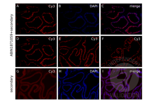 Immunofluorescence validation image for anti-Androgen Receptor (AR) antibody (ABIN1871059) (Androgen Receptor antibody)