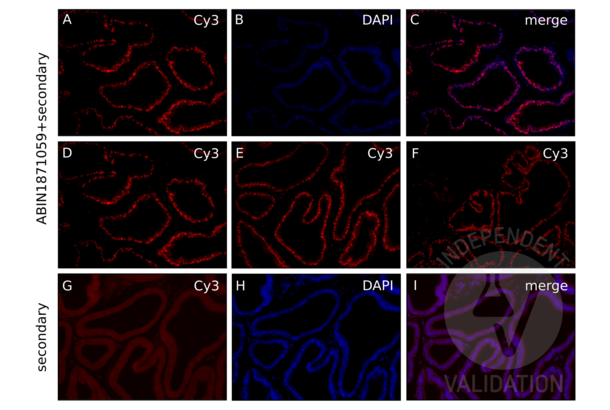 Androgen Receptor antibody