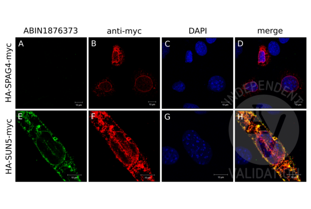 SUN5 antibody