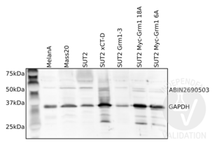 Western Blotting validation image for anti-Solute Carrier Family 1 (Glial High Affinity Glutamate Transporter), Member 3 (SLC1A3) (AA 522-541) antibody (ABIN2690503)