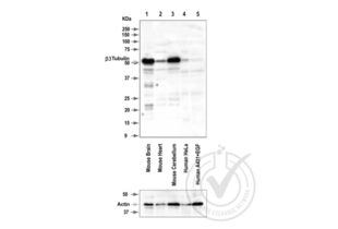 TUBB3 antibody  (AA 443-450)