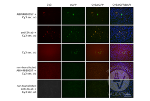 HEK-293 cells transfected with a plasmid expressing SpCas9-T2A-eGFP and stained with ABIN4880057 and a Cy3 conjugated anti-mouse antibody (first row), an anti-2A antibody and a Cy3 conjugated anti-mouse antibody (second row). Staining of transfected cells with the secondary antibody alone (third row) or non-transfected cells with ABIN4880057 or the Cy3–conjugated secondary antibody (forth row) or the the 2A-antibody and Cy3 secondary (fifth row) served as negative controls.