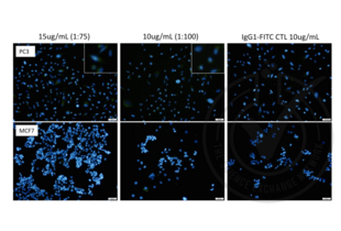Legend: Immunofluorescence. Nestin (green fluorescence) is present in positive control cells (PC3) and absent in negative control cells( MCF7). Scale bar = 50 μm, Magnification = 20X, FITC Exposure = 1.5s, Insets at 40X magnification.
Details:
Left panel: Micrograph image of PC3 Nestin-positive prostate adenocarcinoma cells (top) and MCF7 Nestin-negative breast adenocarcinoma cells (bottom) with 15 μg/mL of anti-Nestin-FITC Ab. 
Middle panel: Micrograph image of PC3 Nestin-positive prostate adenocarcinoma cells (top) and MCF7 Nestin-negative breast adenocarcinoma cells (bottom) with 10 μg/mL of anti-Nestin-FITC Ab. 
Right panel: Micrograph image of reagent isotype control FITC-conjugated mouse IgG1 antibody on PC3 Nestin-positive prostate adenocarcinoma cells (top) and MCF7 breast adenocarcinoma cells (bottom).