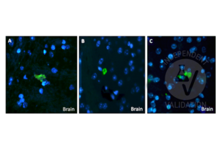 Immunohistochemistry validation image for anti-Amyloid beta (A4) Precursor Protein (APP) antibody (ABIN95037)
