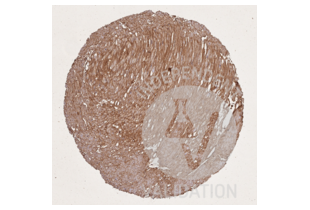 Immunohistochemistry validation image for anti-COL1A2/COL1A1 antibody (ABIN5596819)