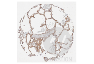 IHC staining of lung tissue with anti-collagen IV antibody ABIN5596835 diluted 1:200 shows staining of basement membranes and vessels.