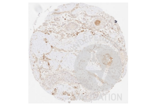 Immunohistochemistry validation image for anti-Collagen, Type III, alpha 1 (COL3A1) antibody (ABIN5596830) (COL3A1 antibody)