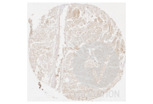 Immunohistochemistry validation image for anti-Collagen, Type III, alpha 1 (COL3A1) antibody (ABIN5596830) (COL3A1 antibody)