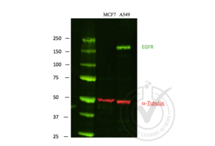 Western Blotting validation image for anti-Epidermal Growth Factor Receptor (EGFR) (C-Term) antibody (ABIN98862) (EGFR antibody  (C-Term))