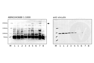Western blot with ABIN1043688 on human pluripotent stem cells (1 and 2), definite endoderm cells (3 and 4), pancreatic endoderm cells (5 and 6), and pancreatic progenitors (7 and 8). ABIN1043688 was used at a 1:1000 dilution. Vinculin served as loading control.
