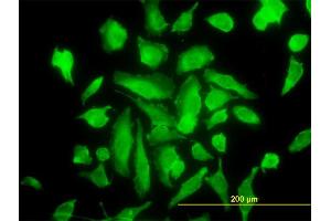Immunofluorescence (IF) image for anti-Protein Kinase C, alpha (PKCa) (AA 563-672) antibody (ABIN562379)