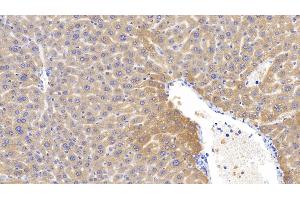 Detection of LCAT in Mouse Liver Tissue using Polyclonal Antibody to Lecithin Cholesterol Acyltransferase (LCAT) (LCAT antibody  (AA 41-210))