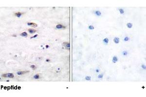 Immunohistochemical analysis of paraffin-embedded human brain tissue using GRIA1 polyclonal antibody . (Glutamate Receptor 1 antibody)
