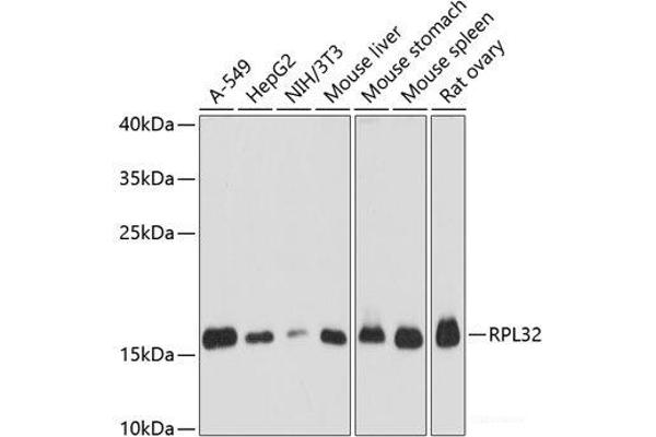 RPL32 anticorps