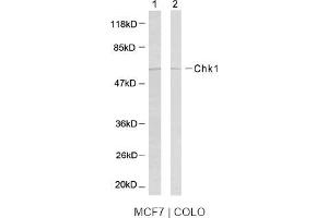 Image no. 2 for anti-Checkpoint Kinase 1 (CHEK1) (Ser317) antibody (ABIN197292) (CHEK1 antibody  (Ser317))