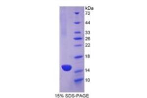 SDS-PAGE (SDS) image for Cadherin 13 (CDH13) ELISA Kit (ABIN6730955)