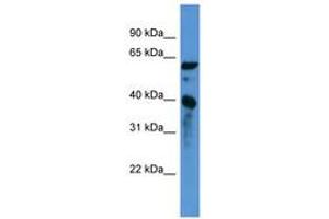 Image no. 1 for anti-Calponin 3, Acidic (CNN3) (C-Term) antibody (ABIN6746734) (CNN3 antibody  (C-Term))