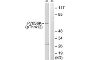 Western blot analysis of extracts from Jurkat cells treated with Insulin 0. (RPS6KB1 antibody  (pThr412))
