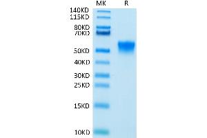 Biotinylated Human FGFR3 beta (IIIc) on Tris-Bis PAGE under reduced condition.