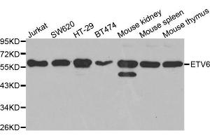 Western blot analysis of extracts of various cell lines, using ETV6 antibody. (ETV6 antibody  (AA 1-300))
