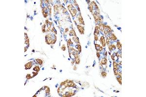 Immunohistochemistry of paraffin-embedded human stomach using RNF149 antibody (ABIN7270062) at dilution of 1:100 (40x lens). (RNF149 antibody  (AA 221-400))