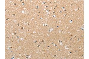 The image on the left is immunohistochemistry of paraffin-embedded Human brain tissue using ABIN7192728(TACR2 Antibody) at dilution 1/20, on the right is treated with synthetic peptide. (TACR2 antibody)