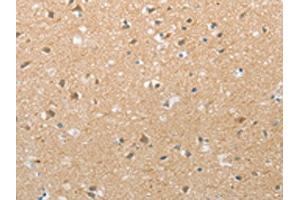 The image on the left is immunohistochemistry of paraffin-embedded Human brain tissue using ABIN7192728(TACR2 Antibody) at dilution 1/20, on the right is treated with synthetic peptide.