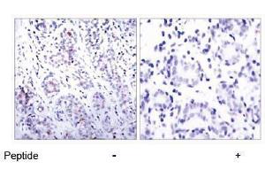 Image no. 1 for anti-Signal Transducer and Activator of Transcription 3 (Acute-Phase Response Factor) (STAT3) (AA 725-729) antibody (ABIN197176) (STAT3 antibody  (AA 725-729))