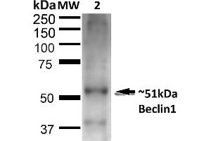 Western blot analysis of Rat Liver showing detection of ~51 kDa Beclin 1 protein using Rabbit Anti-Beclin 1 Polyclonal Antibody (ABIN2868741). (Beclin 1 antibody  (Atto 488))