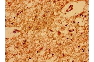 Immunohistochemistry of paraffin-embedded human brain tissue using ABIN7172228 at dilution of 1:100 (TRNP1 antibody  (AA 10-180))