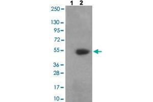 Western blot analysis of Lane 1: antigen-specific peptide treated 3T3 cells, Lane 2: 3T3 cells with CAMK2A/CAMK2B/CAMK2D (phospho T305) polyclonal antibody  at 1:500-1:1000 dilution. (CAMK2A antibody  (pThr305))