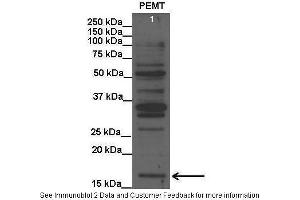 Lanes:   Lane1: 20 ug rat liver lysate  Primary Antibody Dilution:   1:1000  Secondary Antibody:   Anti-rabbit HRP  Secondary Antibody Dilution:   1:15000  Gene Name:   PEMT  Submitted by:   Anonymous (PEMT antibody  (C-Term))