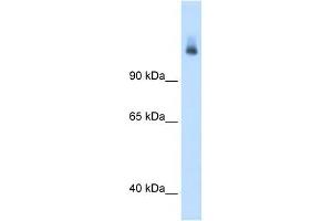 CPS1 antibody used at 1. (CPS1 antibody  (N-Term))