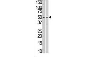 The STK38L polyclonal antibody  is used in Western blot to detect STK38L in Jurkat (left) and T-47D (right) cell line lysates. (STK38L antibody  (C-Term))