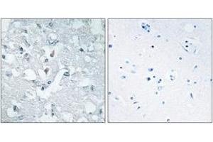 Immunohistochemistry analysis of paraffin-embedded human brain tissue, using GLCTK Antibody. (GLYCTK antibody  (AA 101-150))