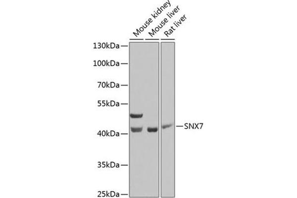 Sorting Nexin 7 抗体  (AA 85-330)