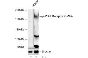 Western blot analysis of extracts of HUVEC cell line, using Phospho-VEGF Receptor 2-Y996 antibody (ABIN6135337, ABIN6136290, ABIN6136291 and ABIN6225613). (VEGFR2/CD309 antibody  (pTyr996))