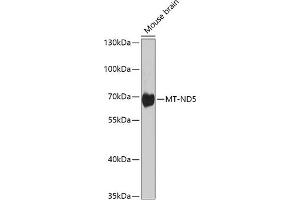 Western blot analysis of extracts of various cell lines, using MT-ND5 antibody (ABIN6135116, ABIN6144435, ABIN6144437 and ABIN6224158) at 1:1000 dilution. (MT-ND5 antibody  (AA 500-600))