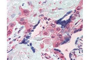Human Placenta: Formalin-Fixed, Paraffin-Embedded (FFPE) (WDHD1 antibody  (AA 975-1025))