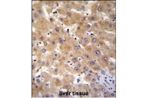 GAGE12B Antibody (N-term) (ABIN655201 and ABIN2844816) immunohistochemistry analysis in formalin fixed and paraffin embedded human liver tissue followed by peroxidase conjugation of the secondary antibody and DAB staining. (G Antigen 12B antibody  (N-Term))