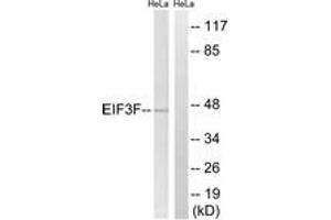 Western blot analysis of extracts from HeLa cells, using EIF3F Antibody. (EIF3F antibody  (AA 81-130))