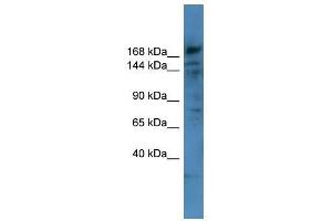 Western Blot showing COL4A6 antibody used at a concentration of 1-2 ug/ml to detect its target protein. (COL4a6 antibody  (Middle Region))