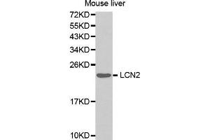 Western Blotting (WB) image for anti-Lipocalin 2 (LCN2) (AA 1-100) antibody (ABIN3017526) (Lipocalin 2 antibody  (AA 1-100))