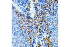 Immunohistochemistry of paraffin-embedded mouse spleen using J Rabbit mAb (ABIN7268036) at dilution of 1:100 (40x lens). (JAK1 antibody)