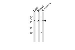 Western blot analysis of lysates from Daudi cell line, human heart and ncreas tissue lysate(from left to right), using CSIN1 Antibody (G23) (ABIN392664 and ABIN2842162).