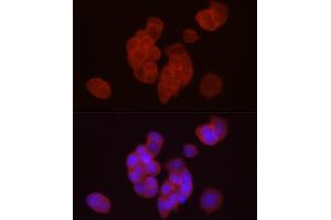 Immunofluorescence (IF) image for anti-Diacylglycerol O-Acyltransferase 1 (DGAT1) (AA 200-300) antibody (ABIN6139556)
