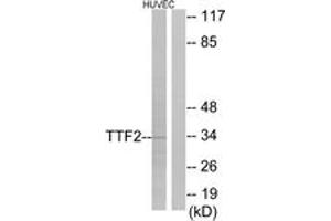 Western Blotting (WB) image for anti-Forkhead Box E1 (Thyroid Transcription Factor 2) (FOXE1) (AA 10-59) antibody (ABIN2889304) (FOXE1 antibody  (AA 10-59))